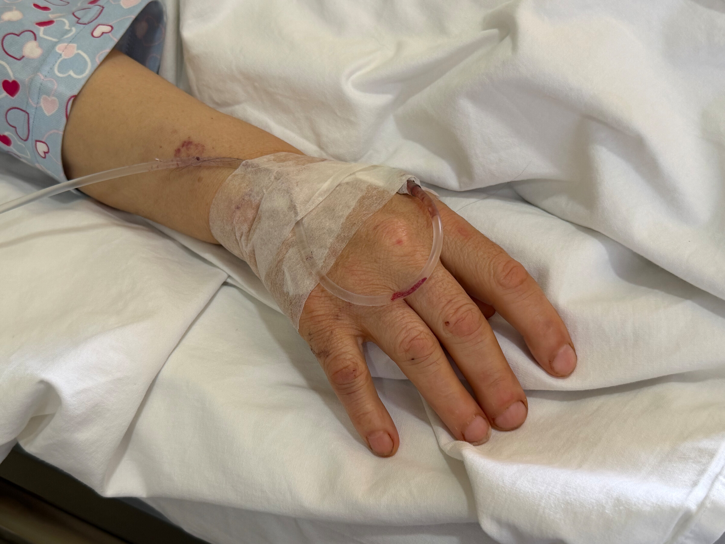 Hand van de gewonde verpleegkundige