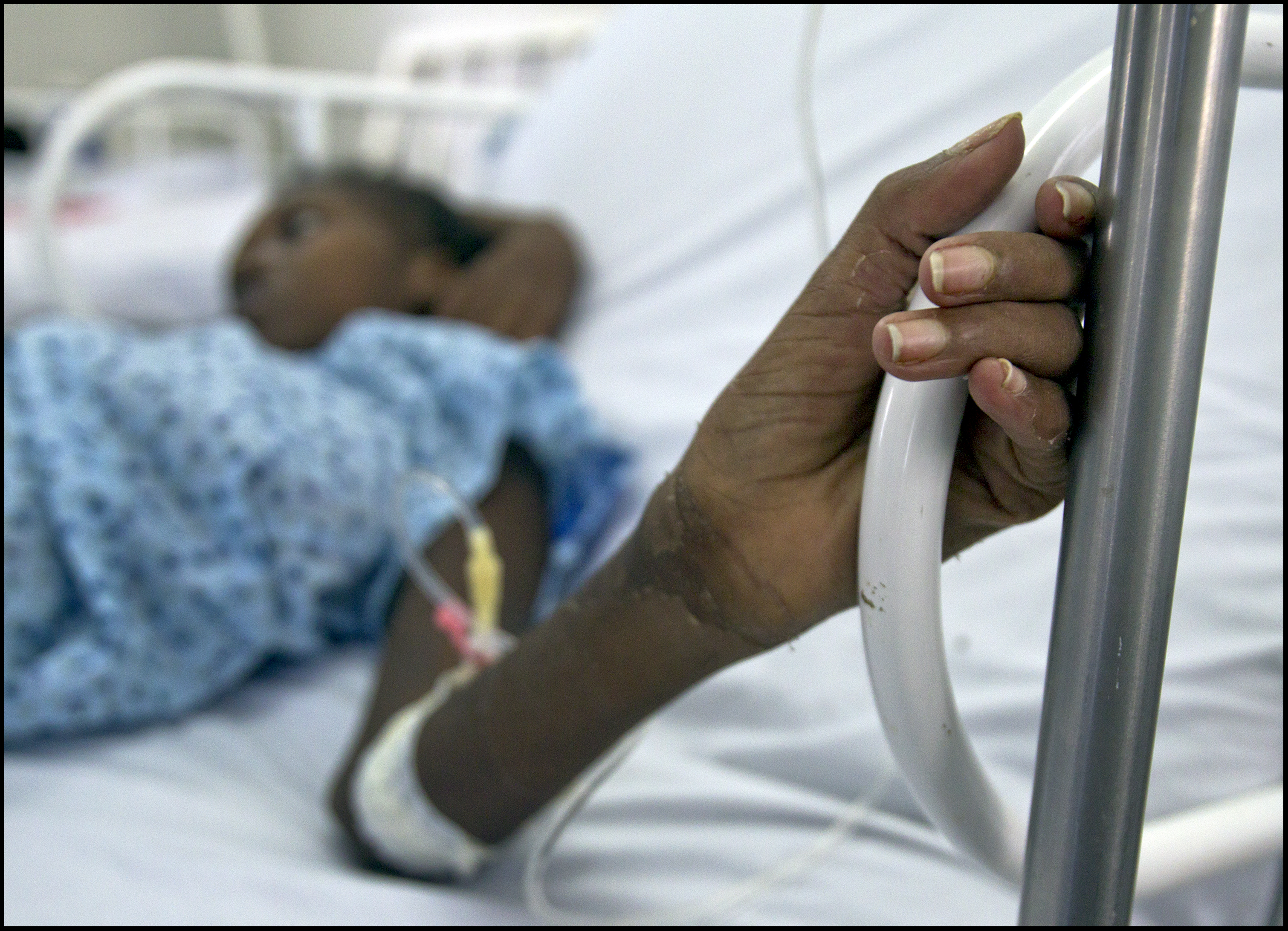 Dit 20-jarig meisje werd in onze kliniek in Port-au-Price, Haïti, binnengebracht na een illegale ingreep door een zogeheten "charlatan". Haar baarmoeder was geperforeerd en ze leed aan hevig vochtverlies