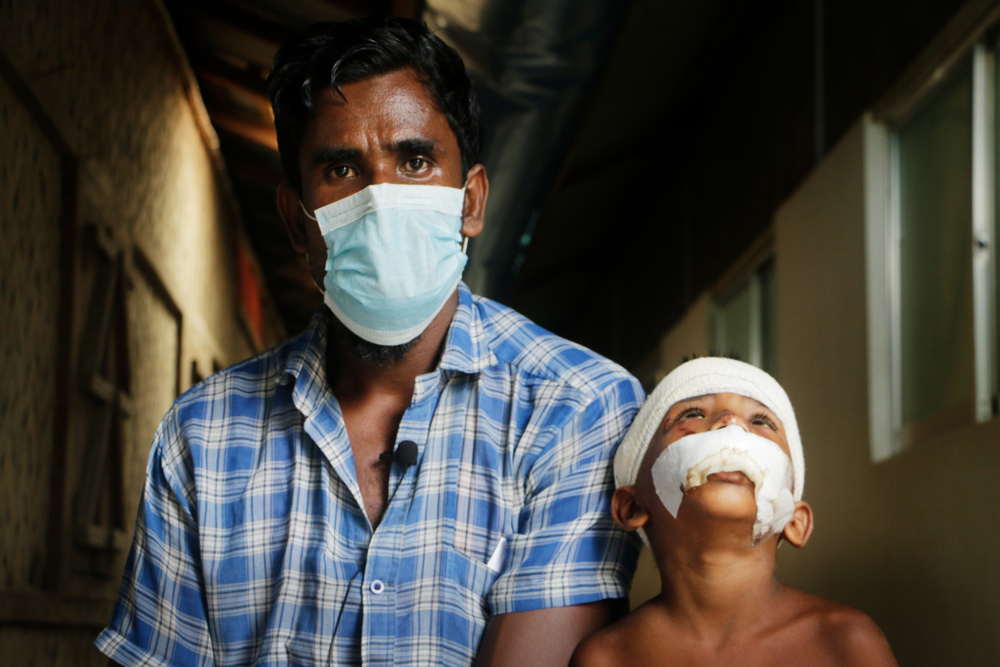 Abu Siddik est originaire de l'État de Rakhine au Myanmar. Il vit maintenant dans un camp de réfugiés à Cox’s Bazar avec ses deux filles, trois fils et sa femme. Sur la photo, il se trouve à l'hôpital MSF de Kutupalong avec son fils de cinq ans, Rashid Ullah, qui se remet de certaines blessures 